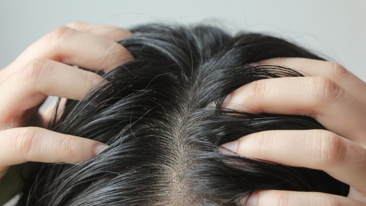 Controls-Oily-Scalp