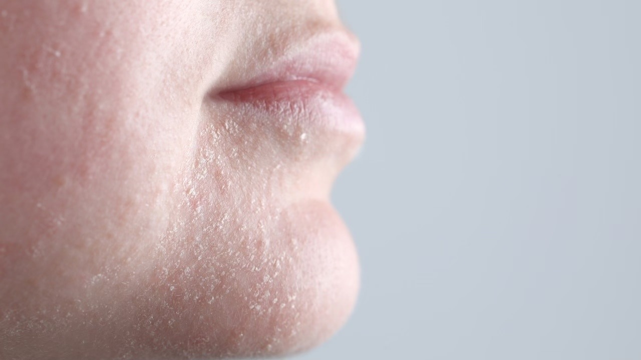 Fighting Dryness and Dehydration