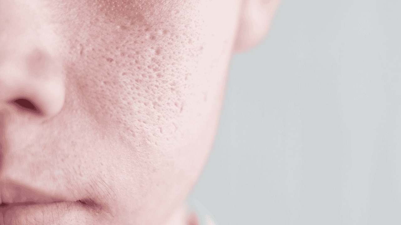 Minimising Pores