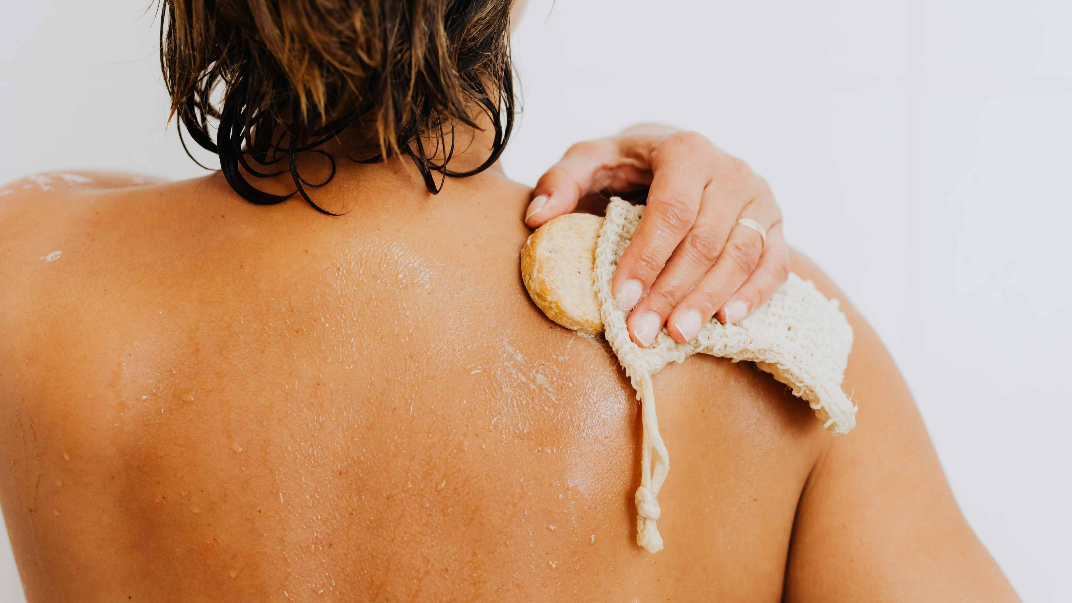 Lack of Exfoliation