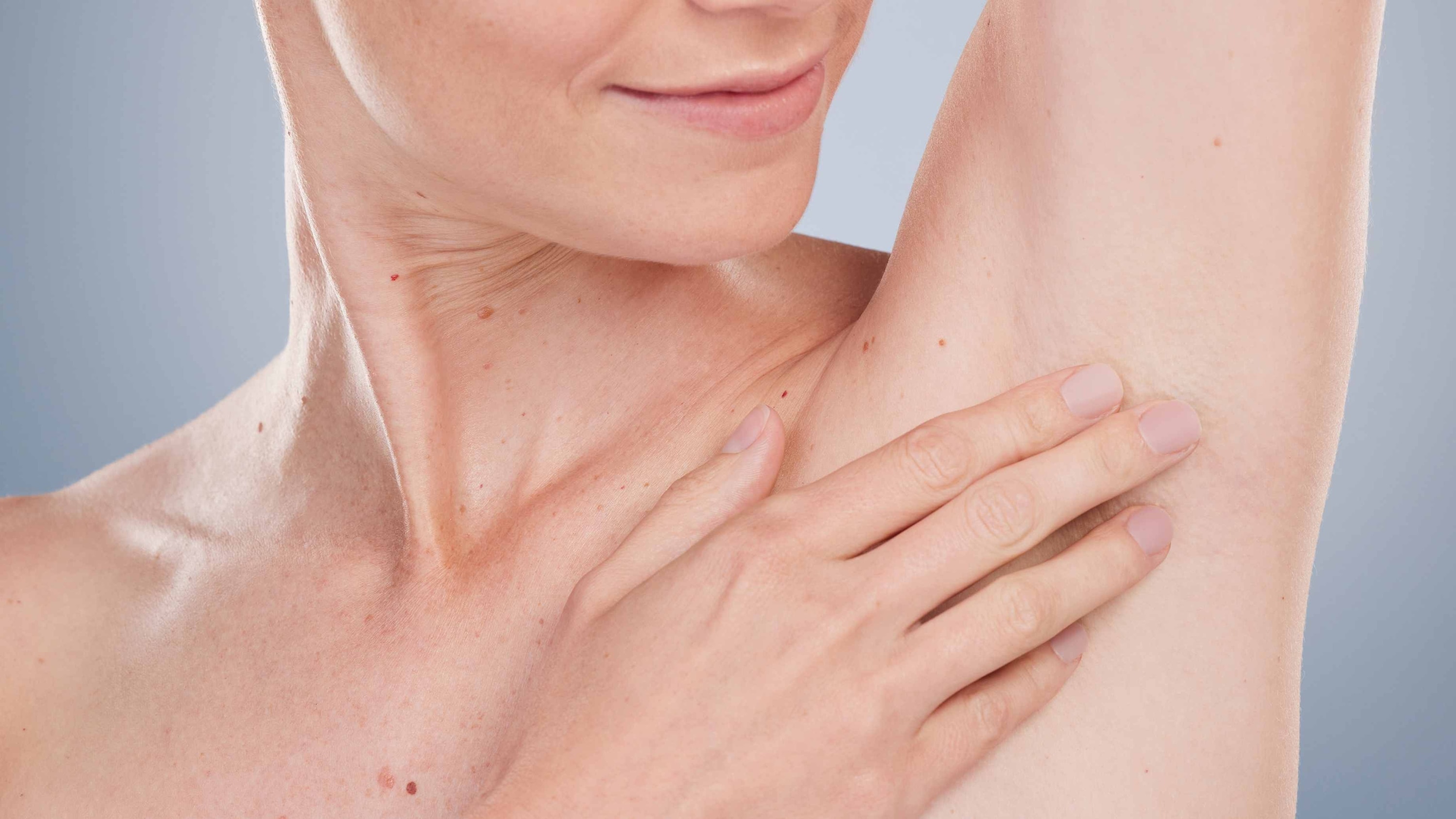 Post-Inflammatory Hyperpigmentation