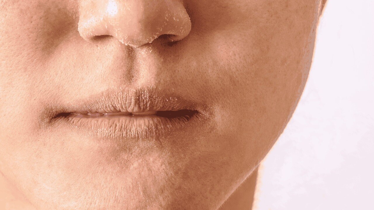Dry Skin