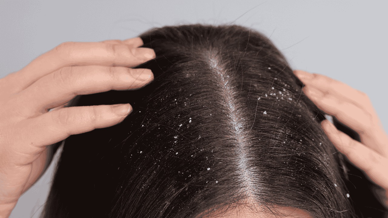 Clove benefits for the hair