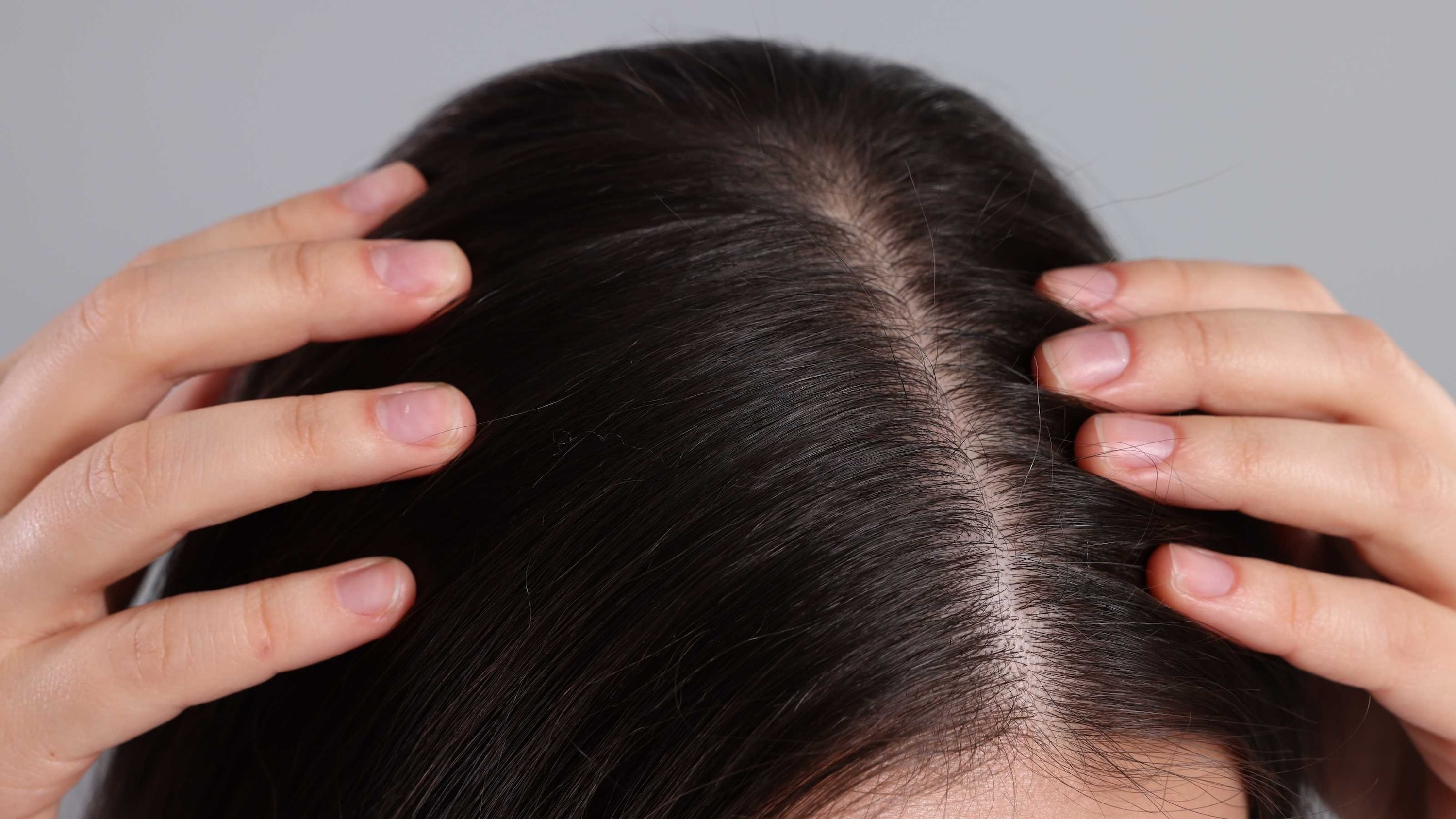 Fights Dandruff and Soothes Itchy Scalp