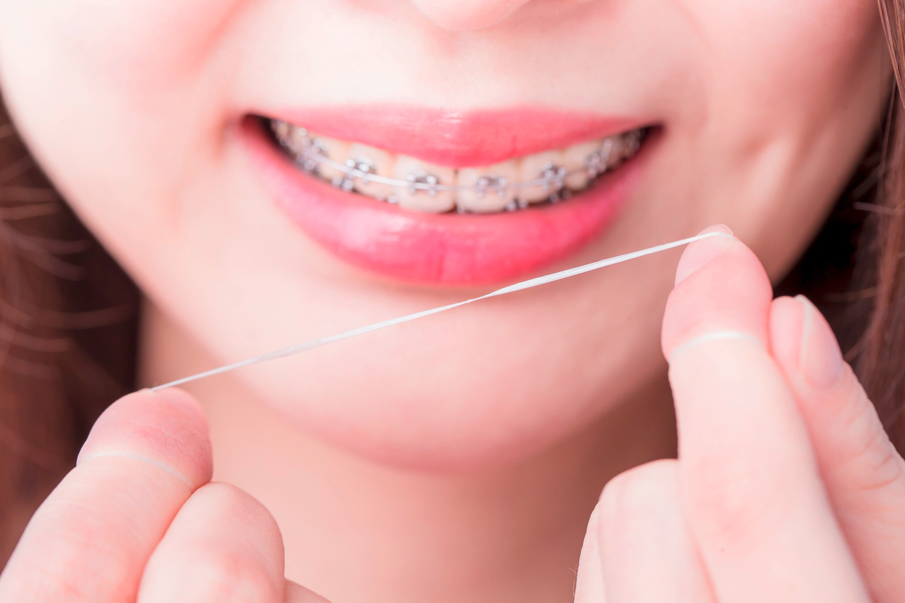 Close-up of a woman with braces holding dental floss.