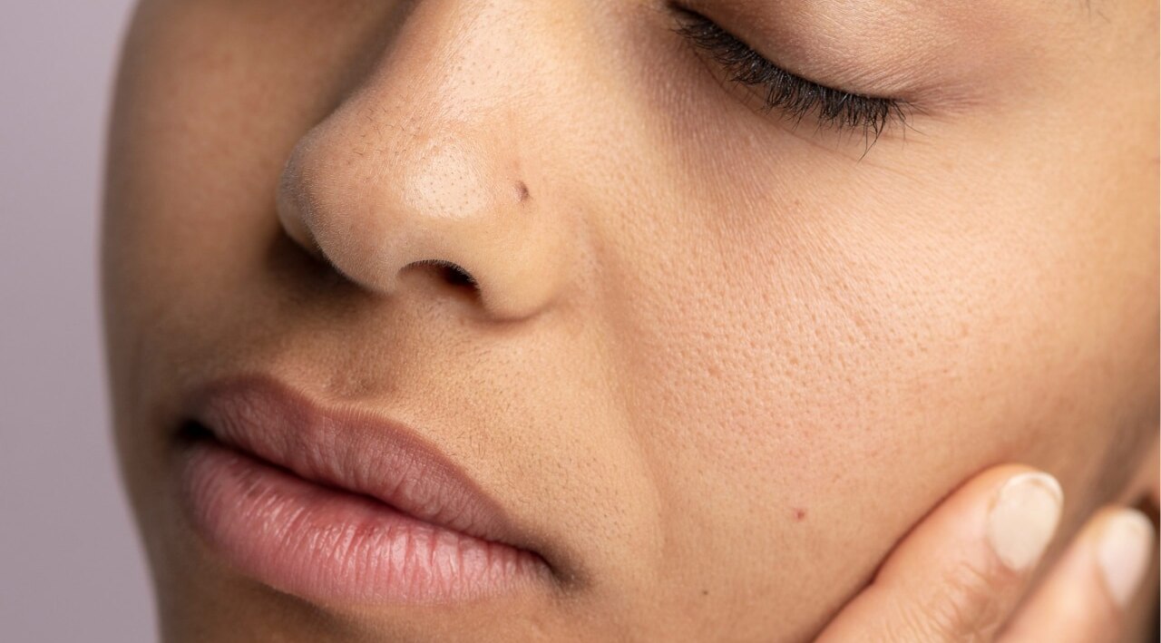 5. Tightens Pores