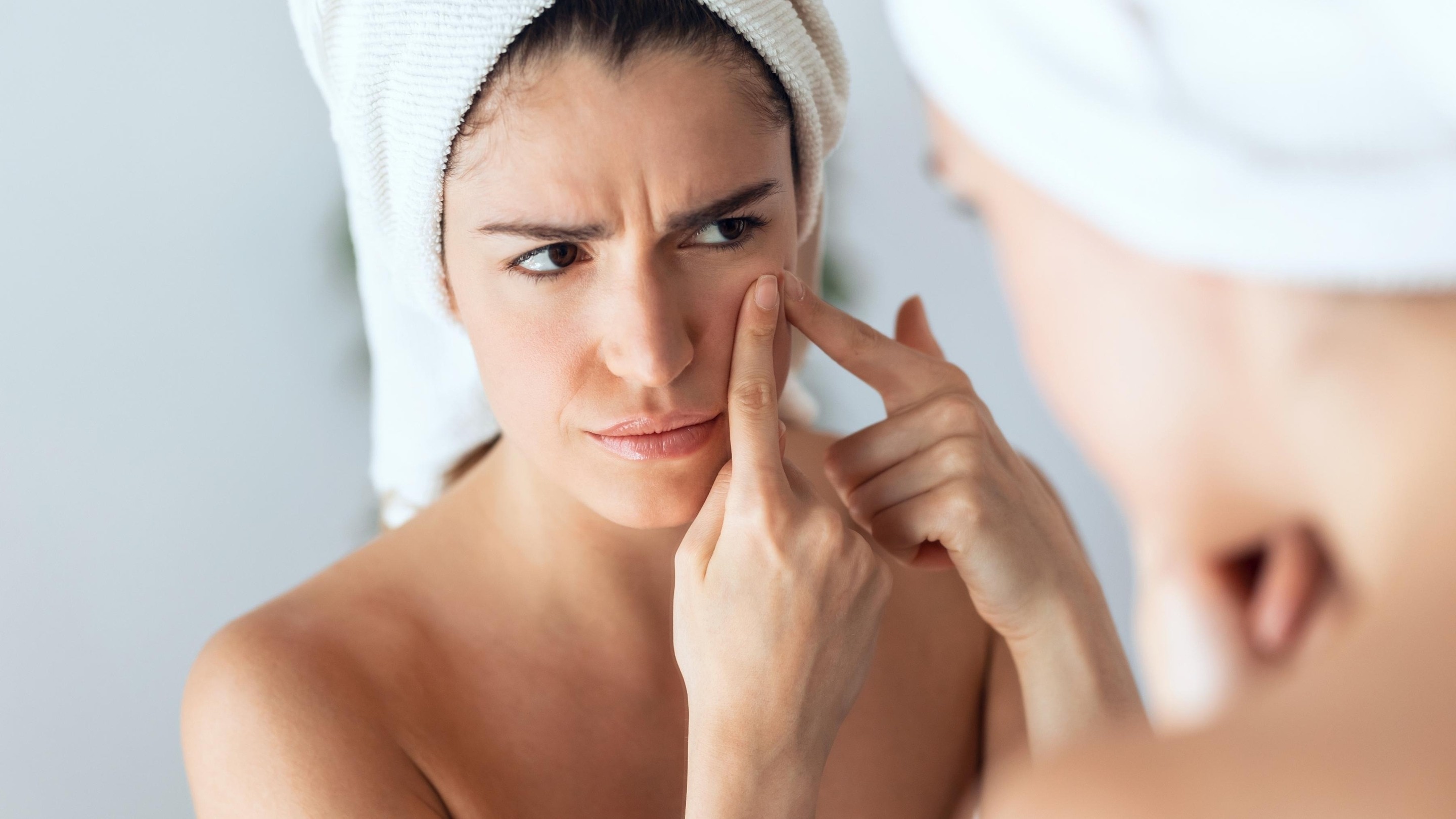Image of How to Remove Pimples Overnight: Fast, Natural & Dermatologist-Approved Treatments