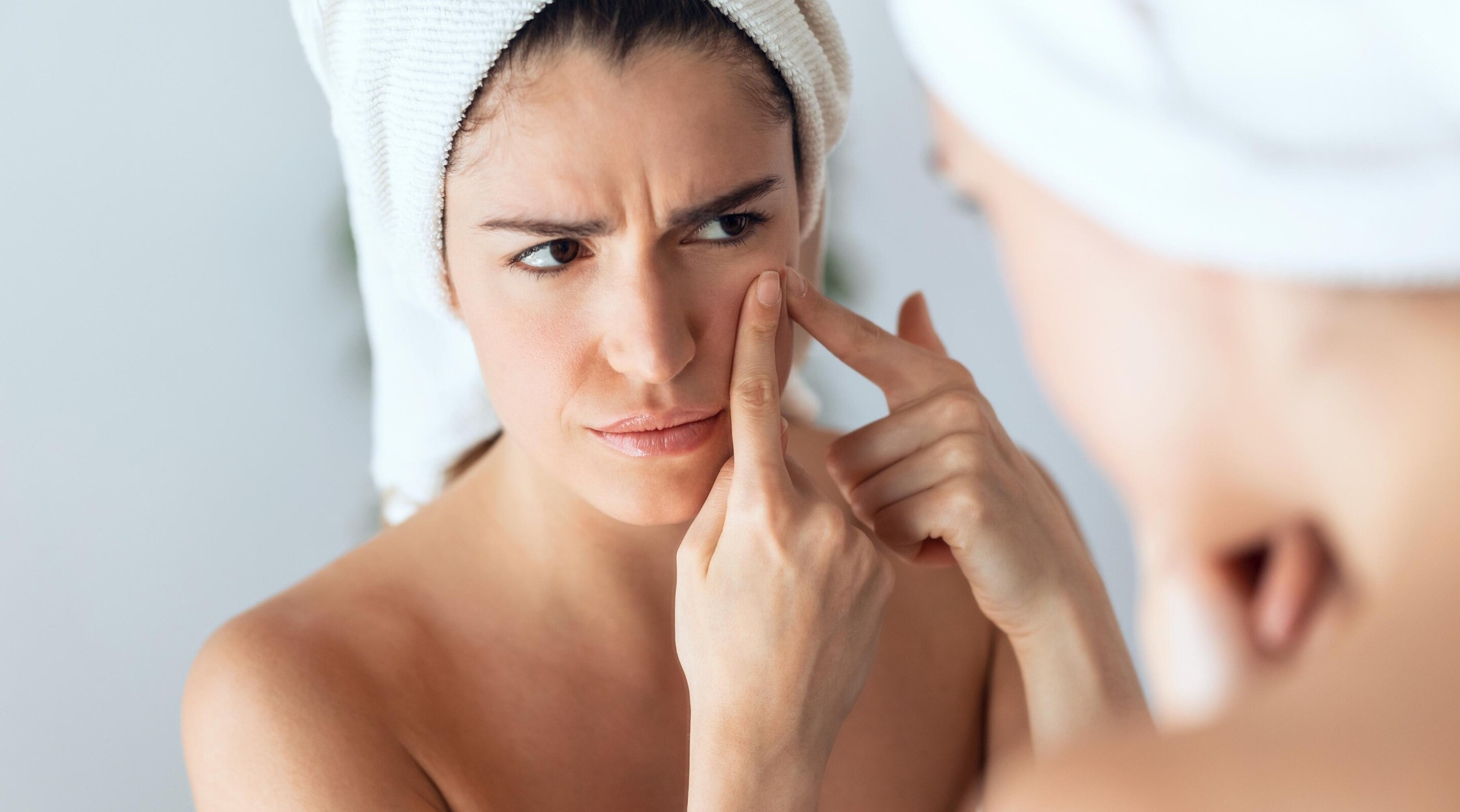 How to Remove Pimples Overnight: Fast, Natural & Dermatologist-Approved Treatments