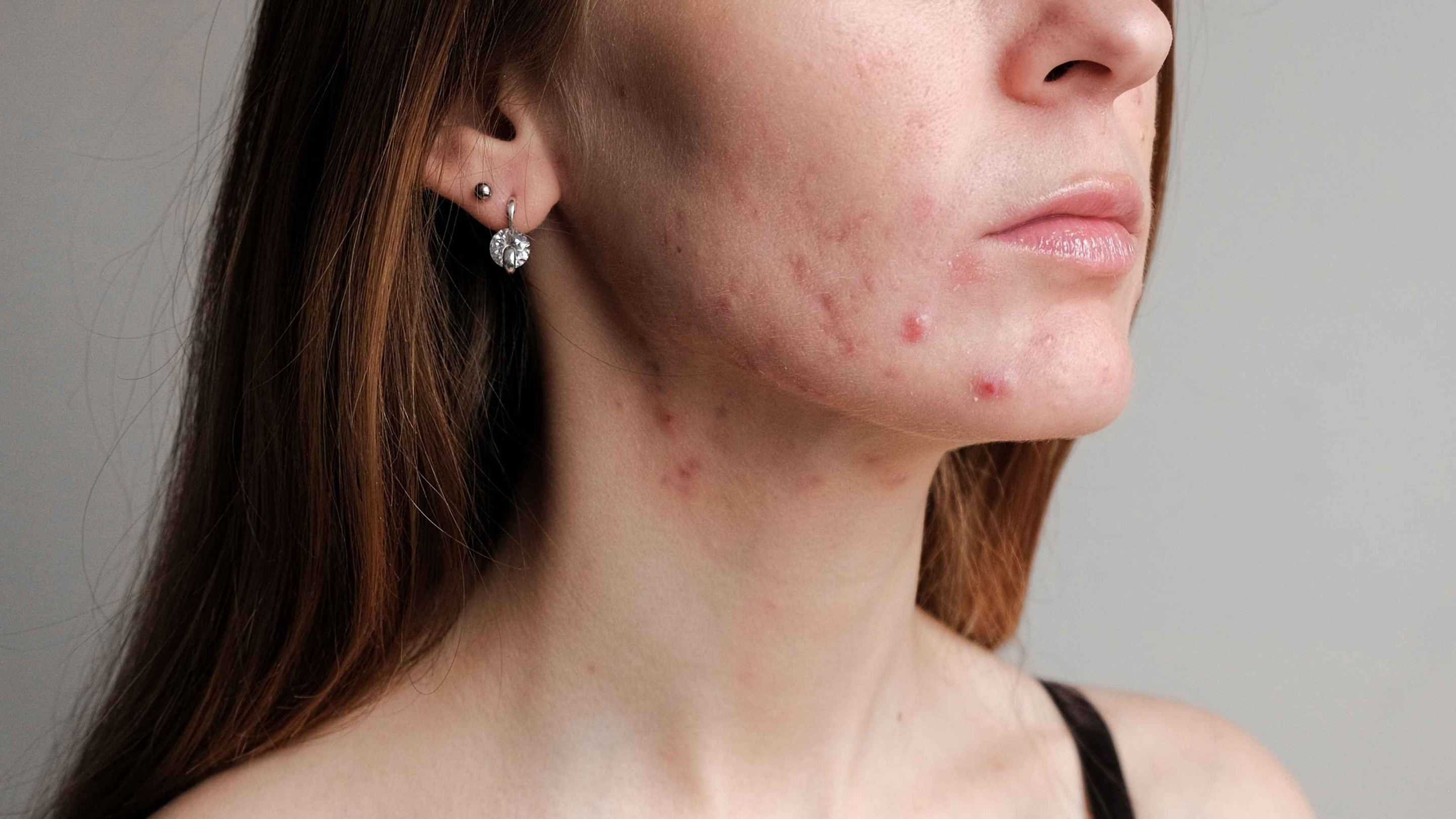 Image of The Ultimate Expert-Approved Routine for Sensitive Skin
