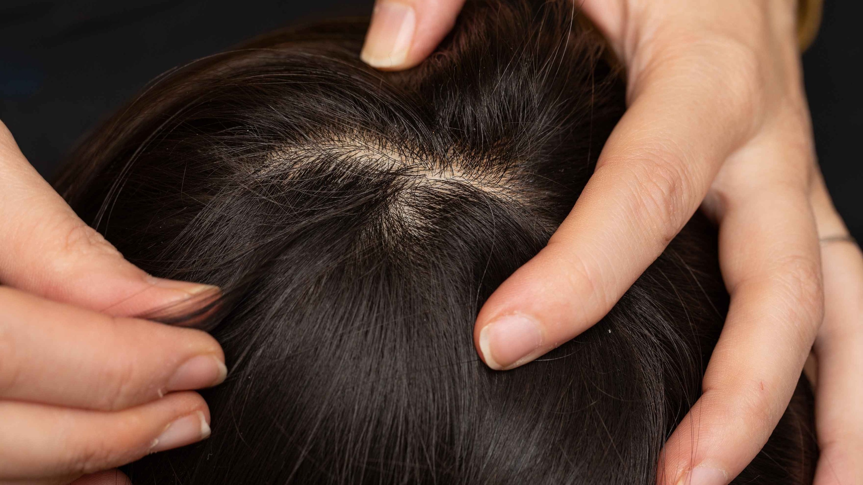 Strengthens Hair Roots