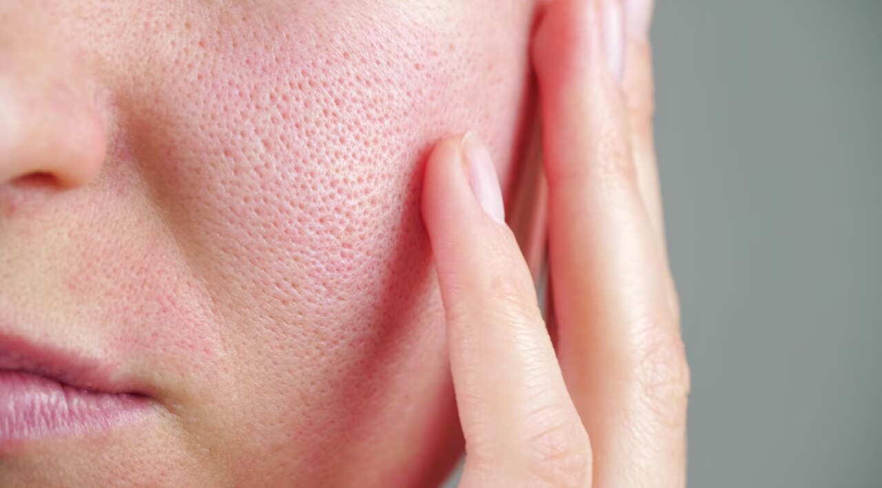 Minimizes Pores Image