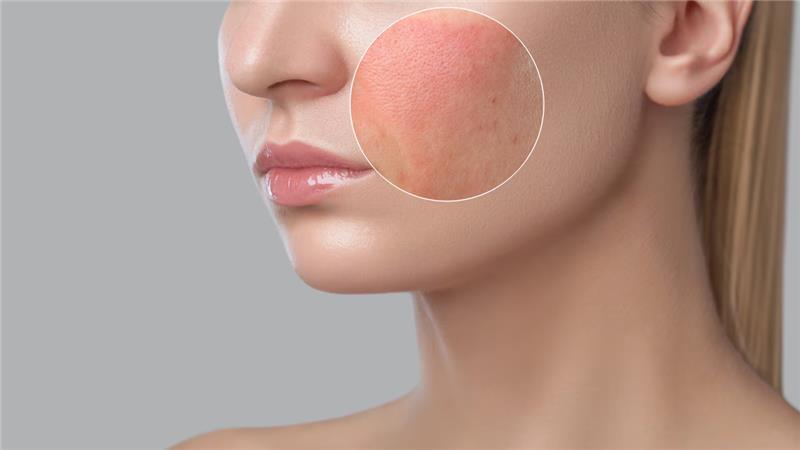 reduces-inflammation-img