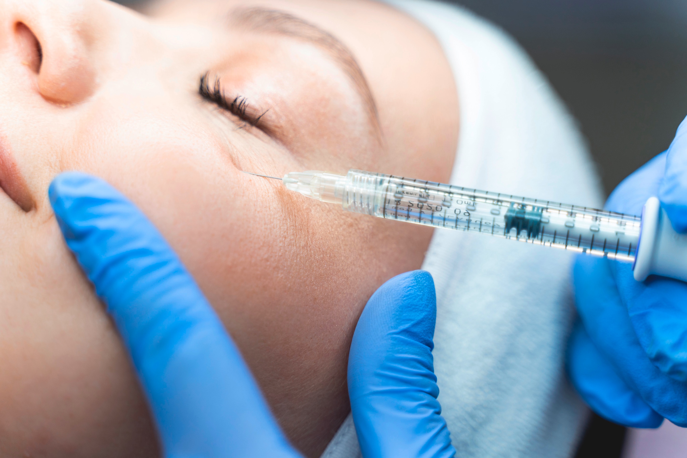 Woman getting her eyebag injected with dermal filler.