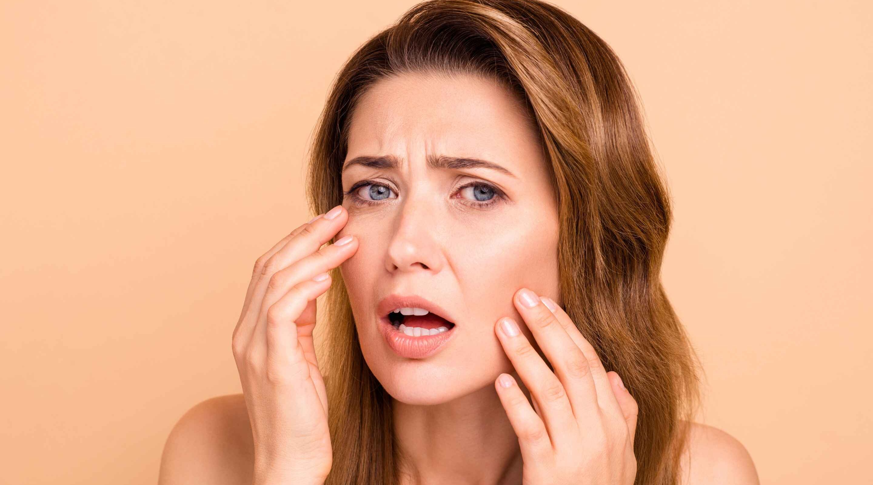 10 Home Remedies To Help You Get Rid Of Puffy Eyes