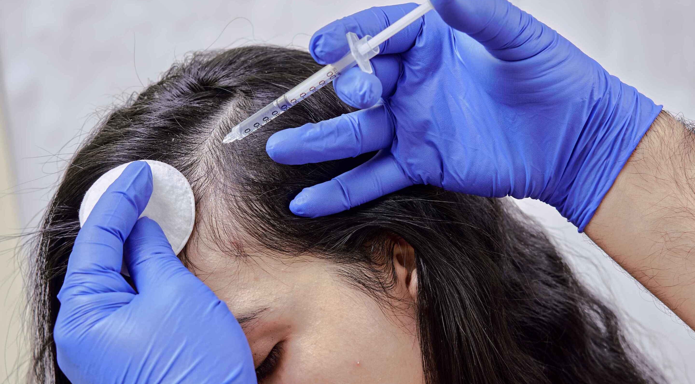 What are the advantages of mesotherapy?