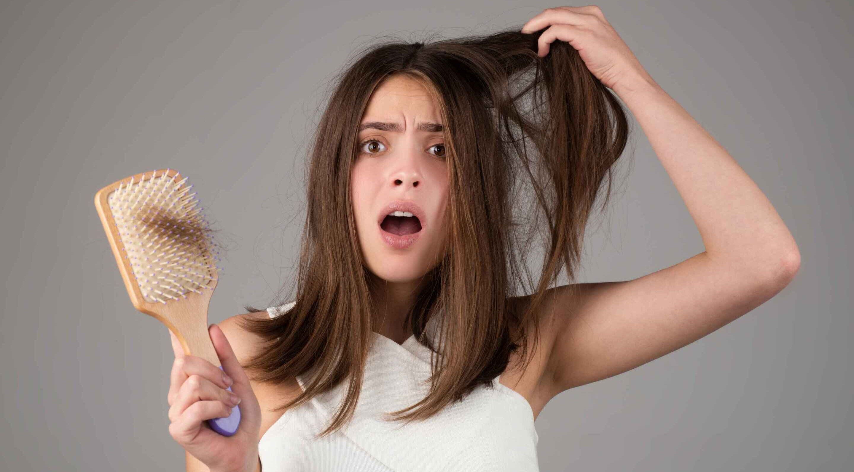 alopecia