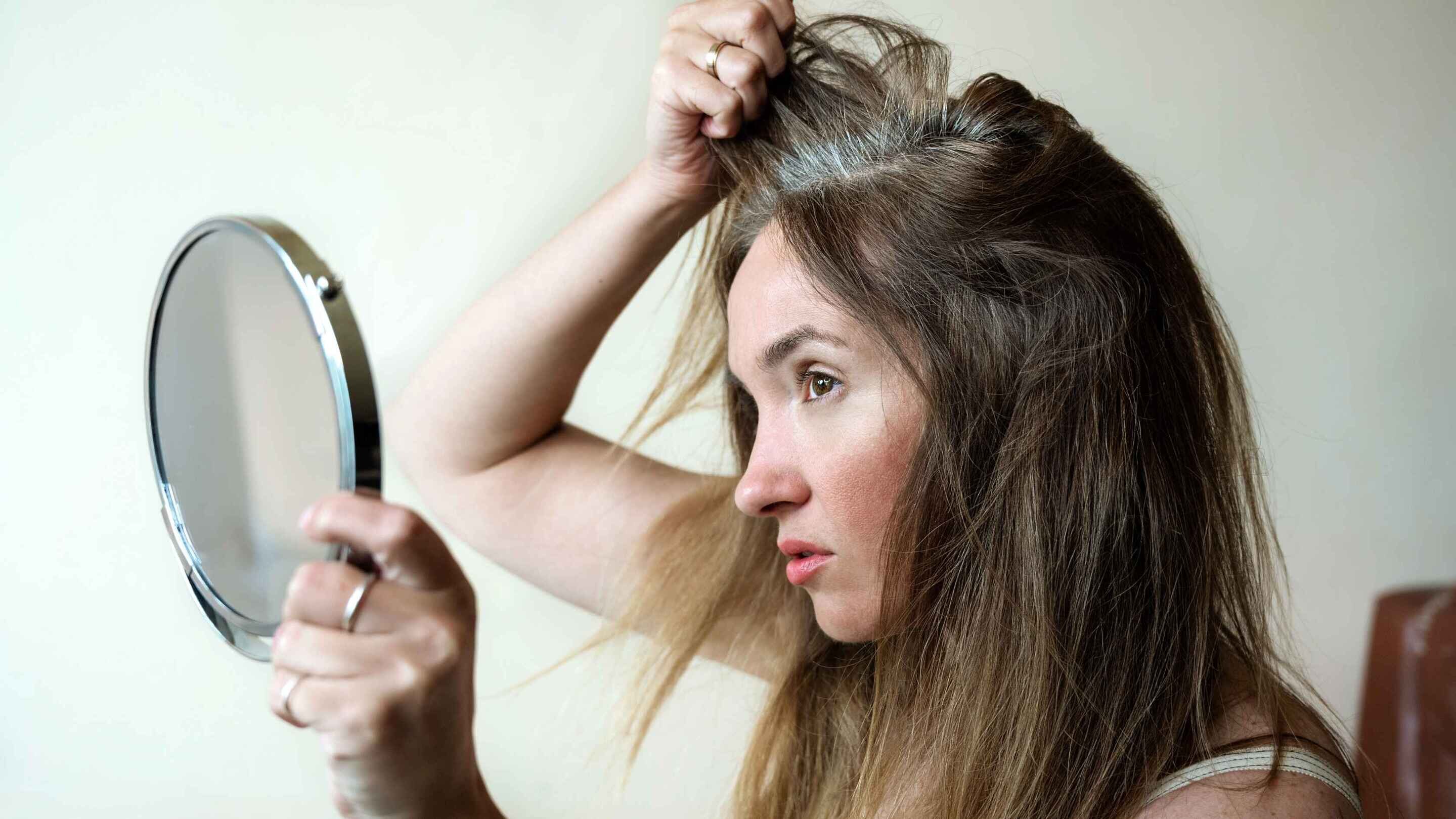Causes of grey hair