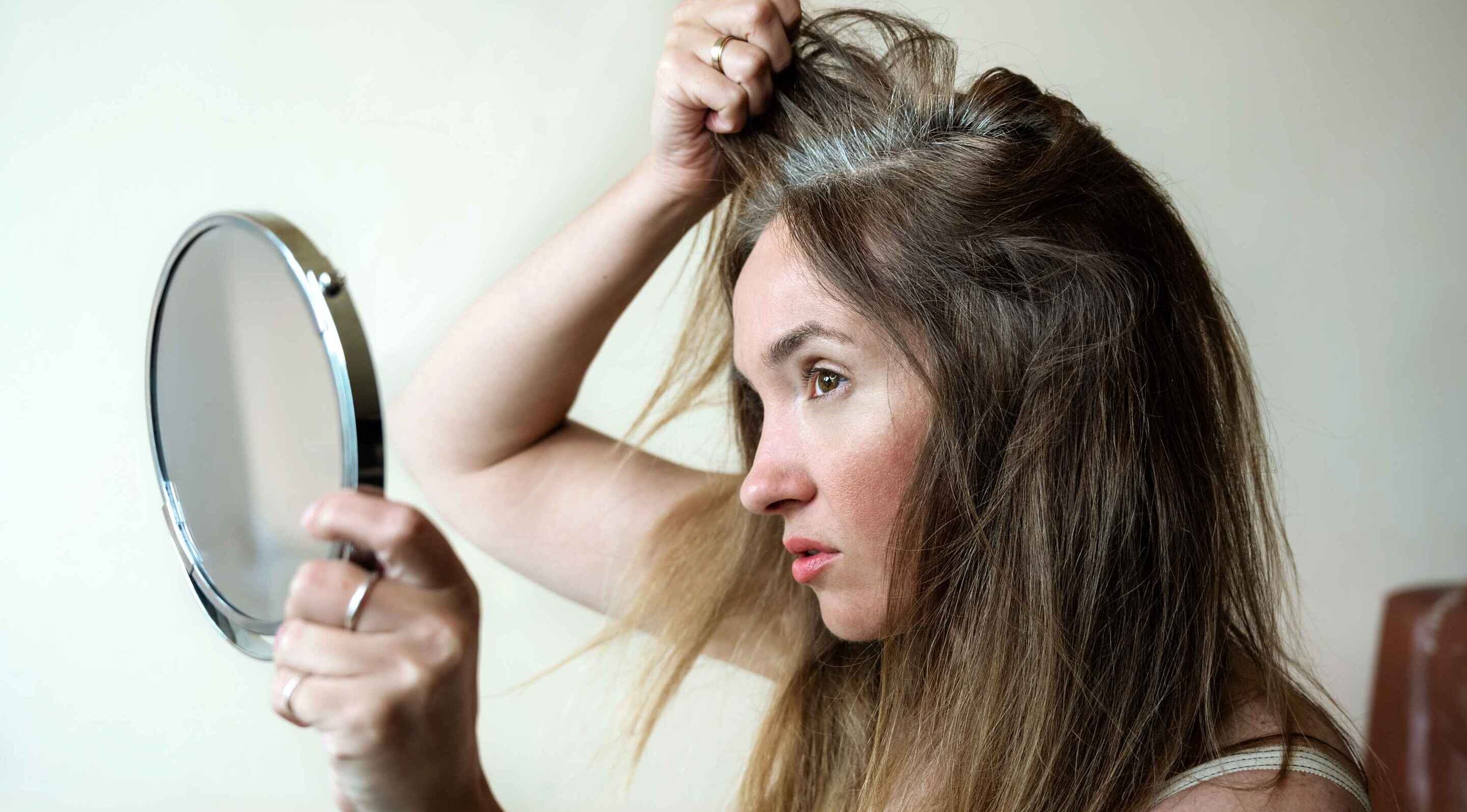 Causes of grey hair