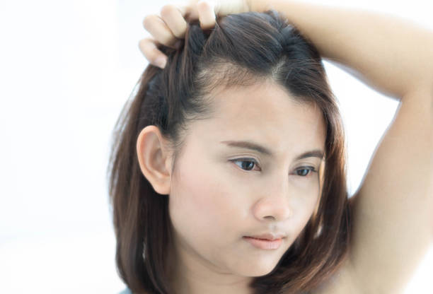 The Link Between Hair Fall And Scalp Health