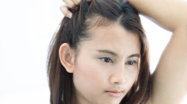 The Link Between Hair Fall And Scalp Health