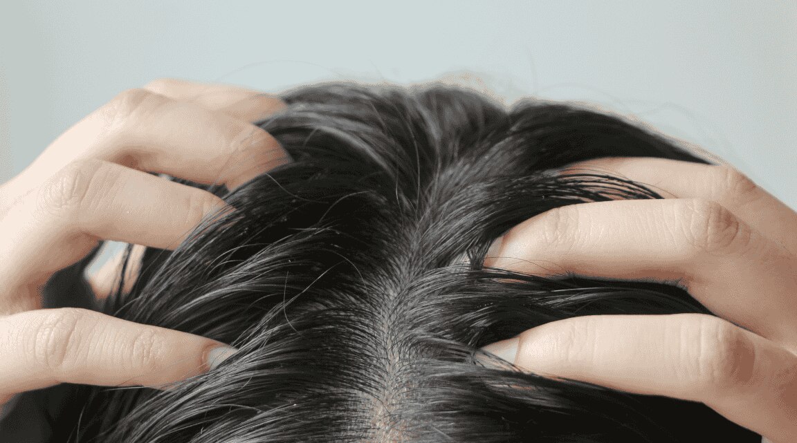 How To Get Rid Of Greasy Hair Without Having To Wash It