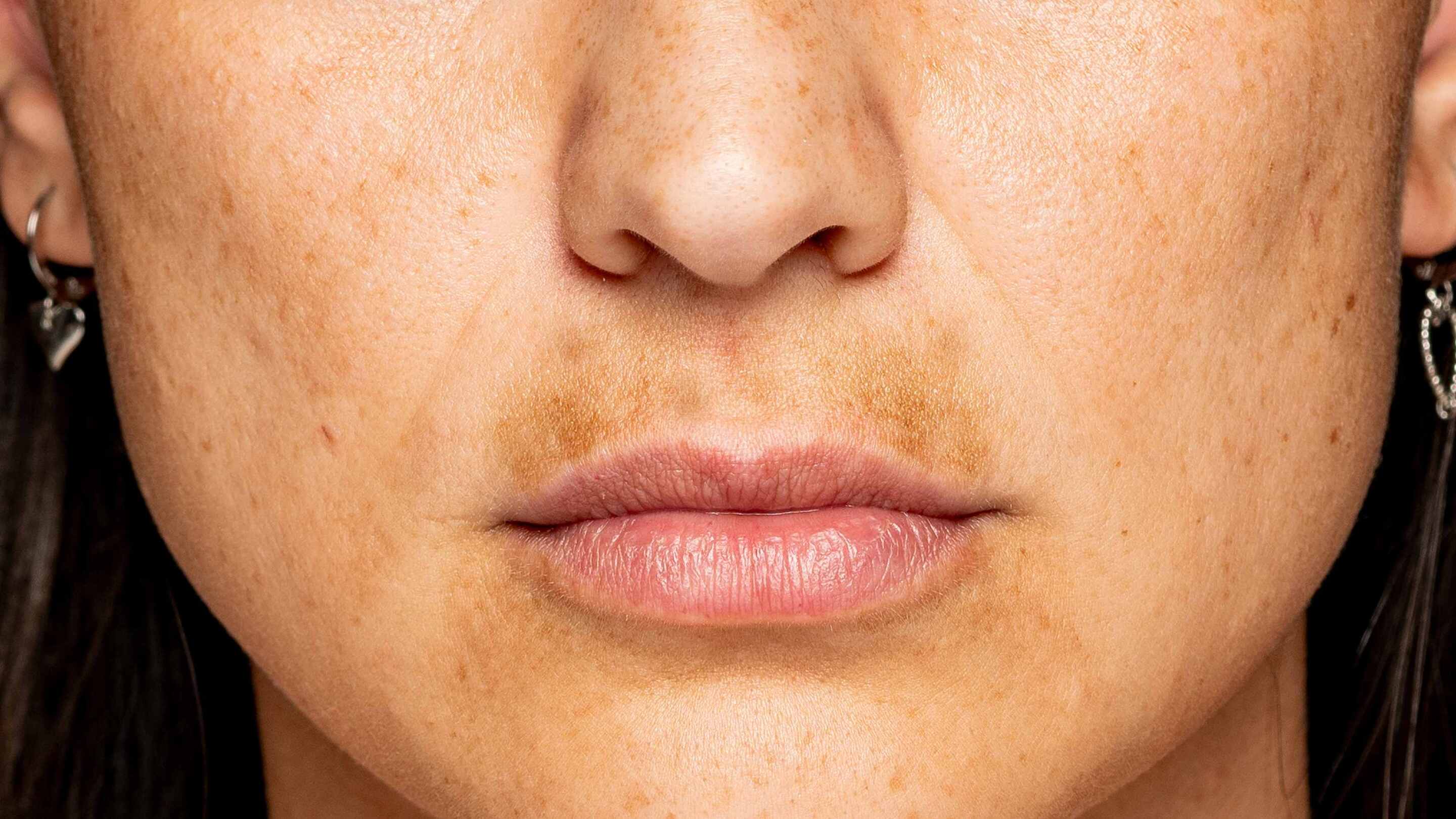 Reduces discolouration