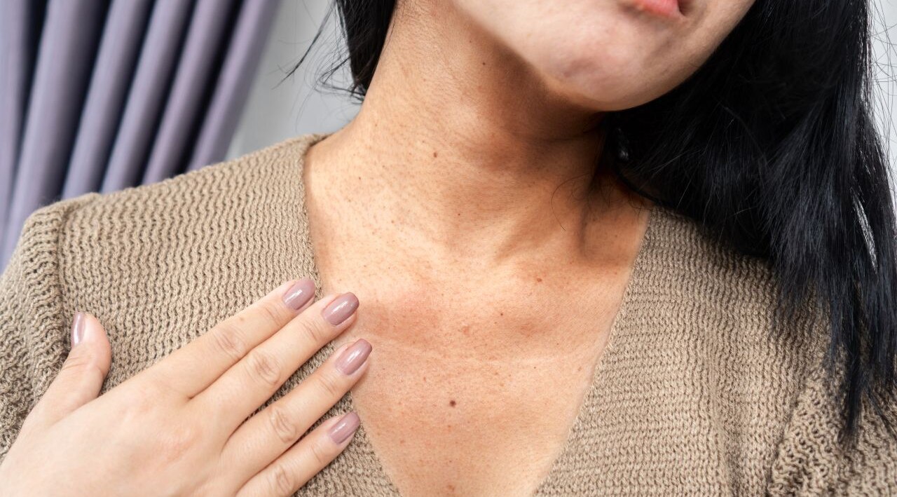 What is a black neck?