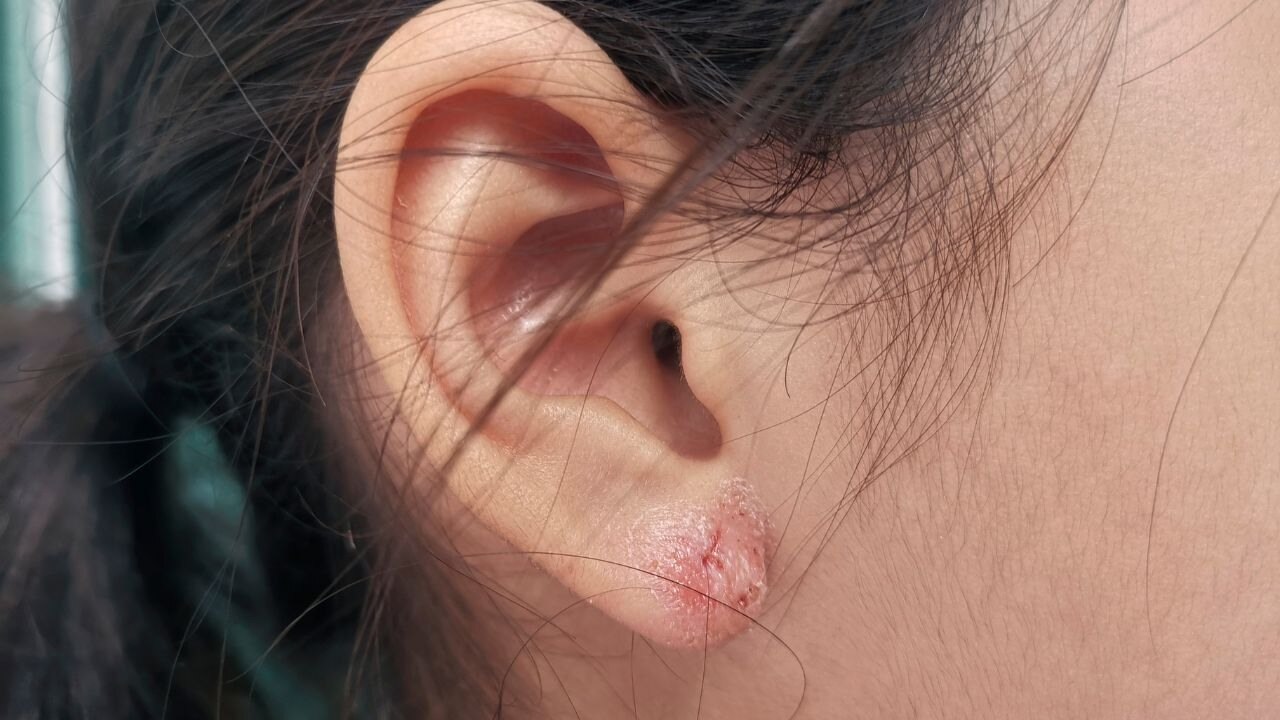 Is the piercing infected? 