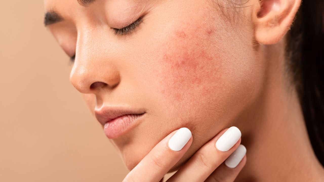 Slower healing of skin issues: