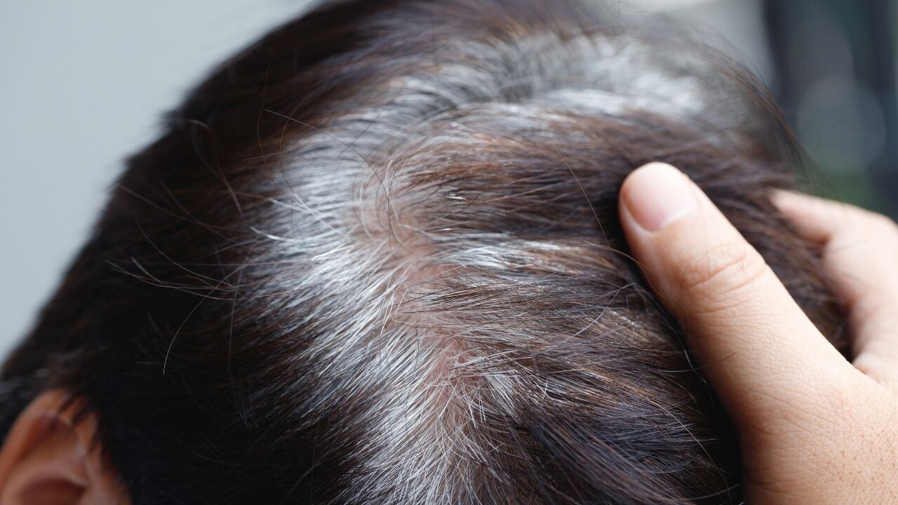 4. Neem oil prevents premature greying