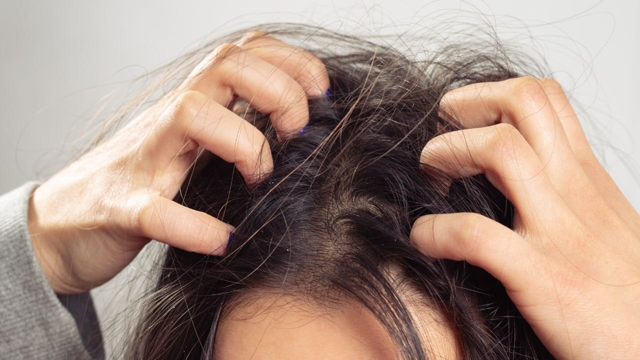 Neem oil treats scalp infections