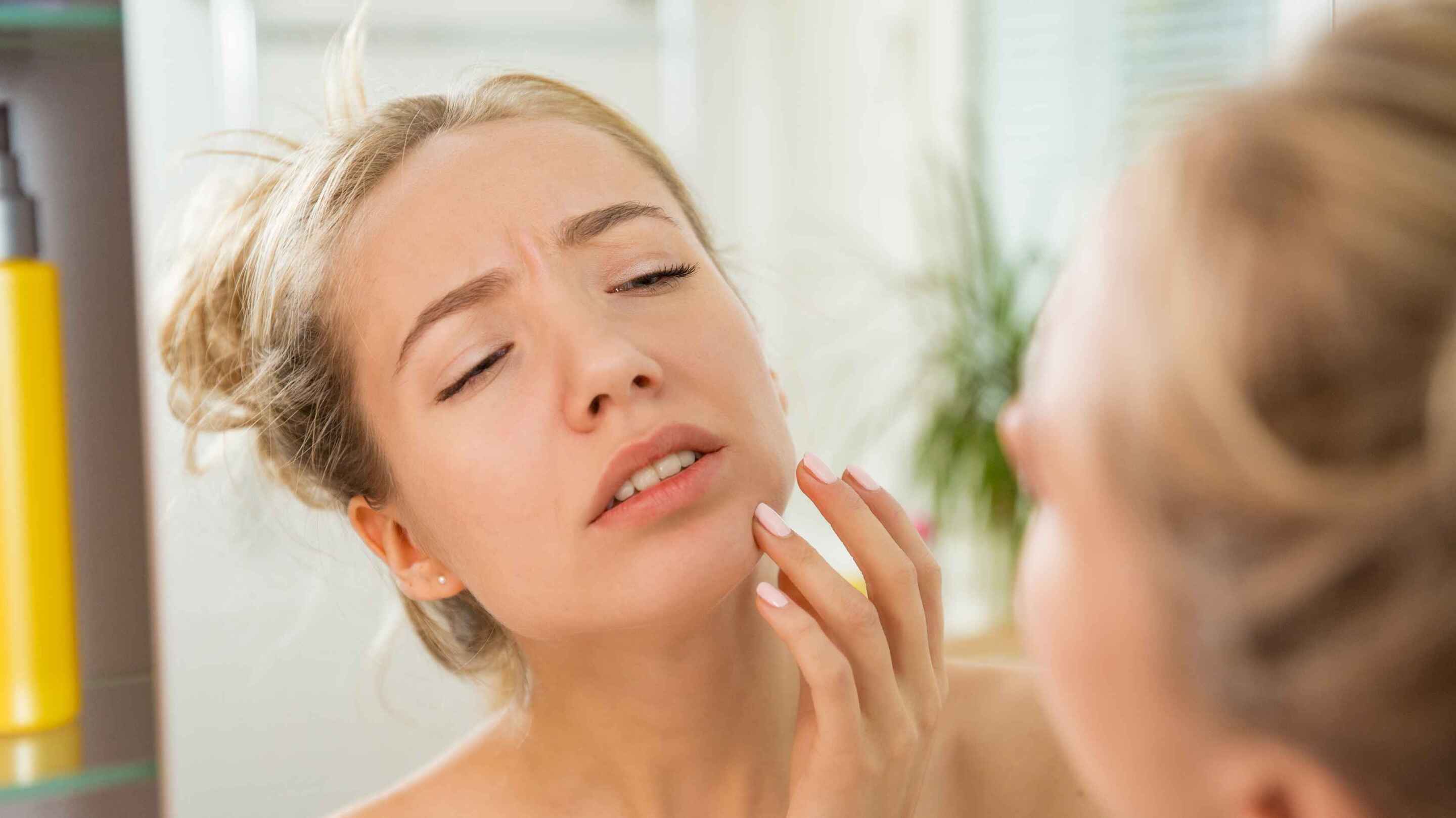 Are there any side effects to using benzoyl peroxide for acne?