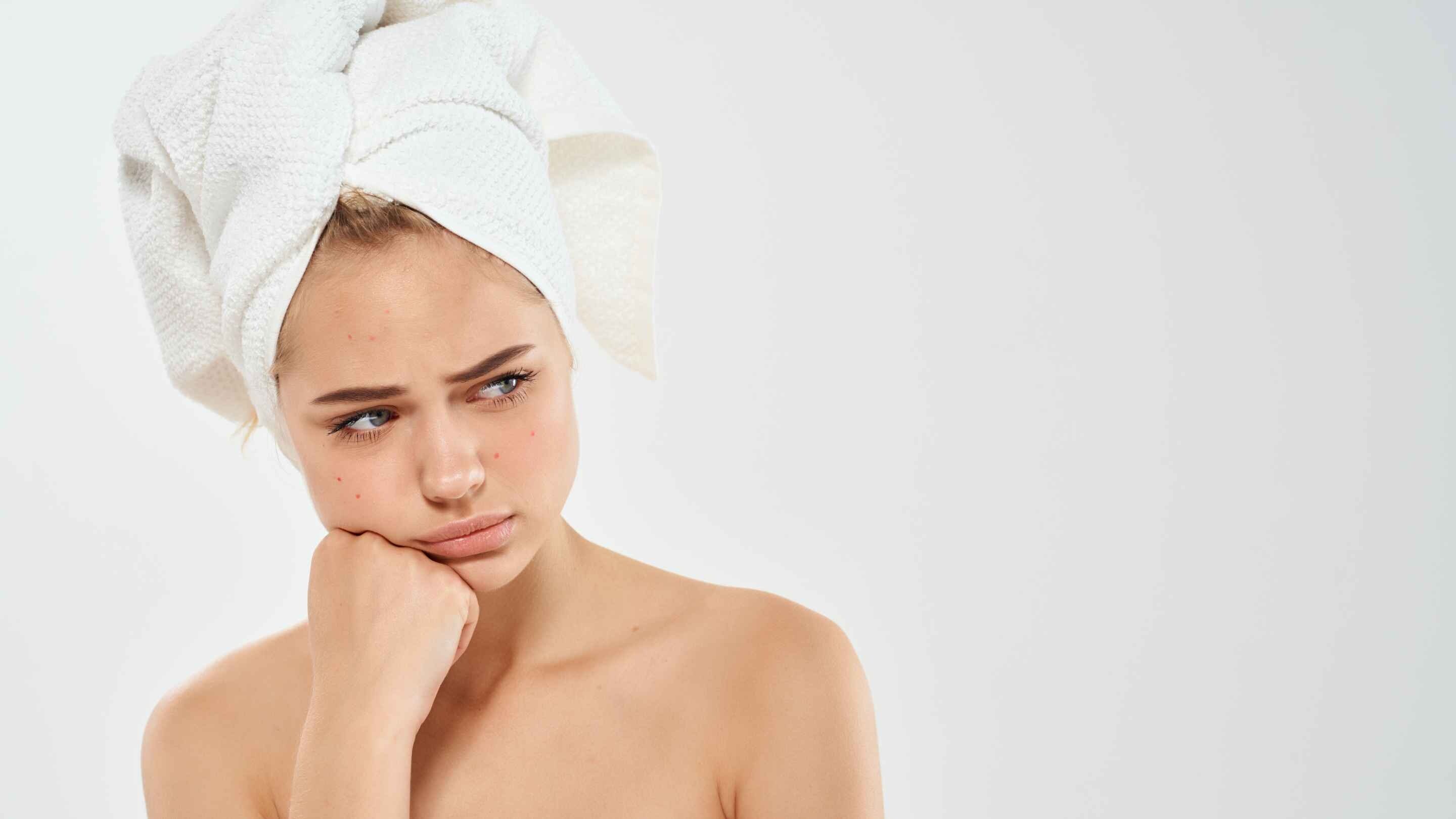 Facial Dandruff: Here's Everything You Need To Know About It