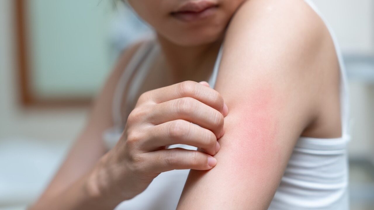 How to stop the skin from itching after a shower?