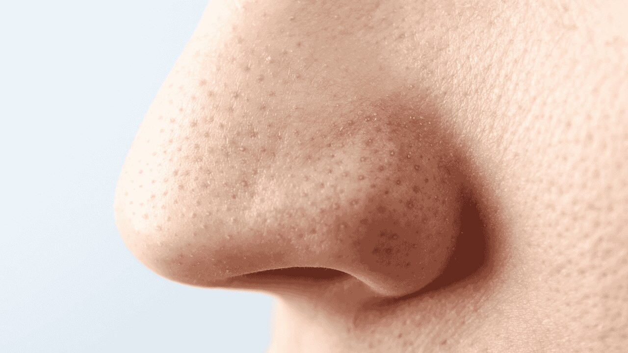 Reduces Blackheads and Whiteheads