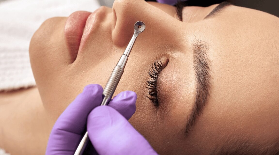 Remove Blackheads From Your Nose With These 7 Top Tips