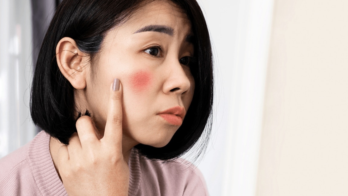 An Expert Explains Why You Could Have An Itchy Face And WHAT TO DO ABOUT IT
