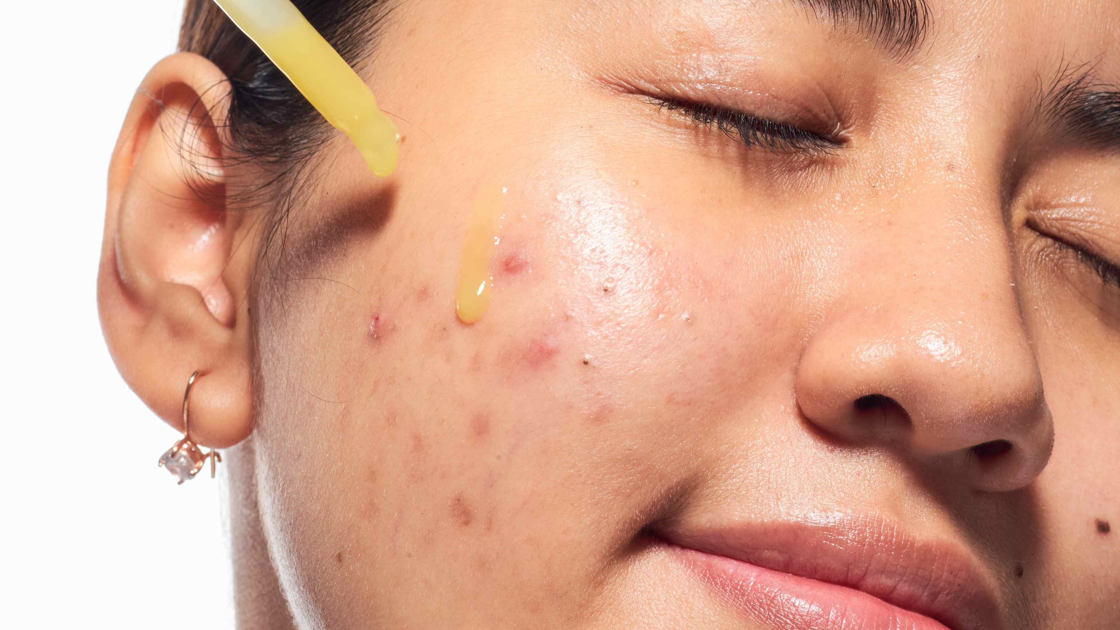Step 3: Apply Your Treatment Serum