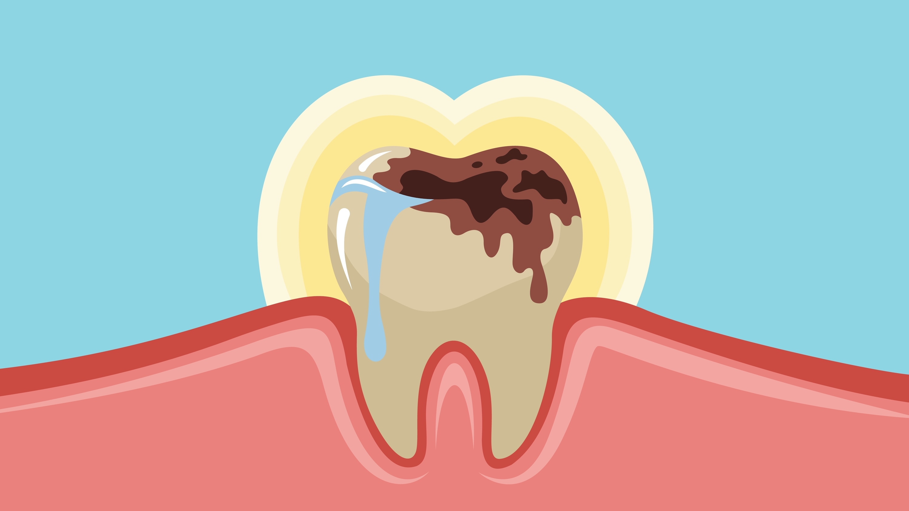 gigi berlubang hitam