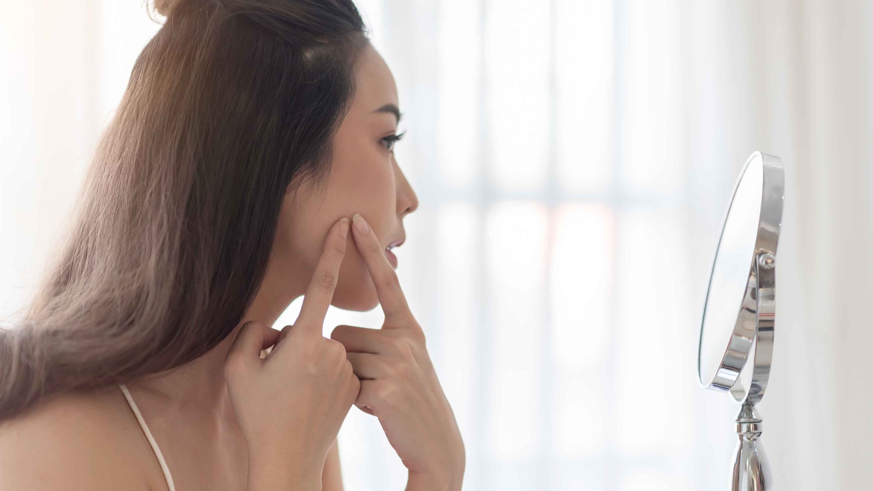 Fights acne