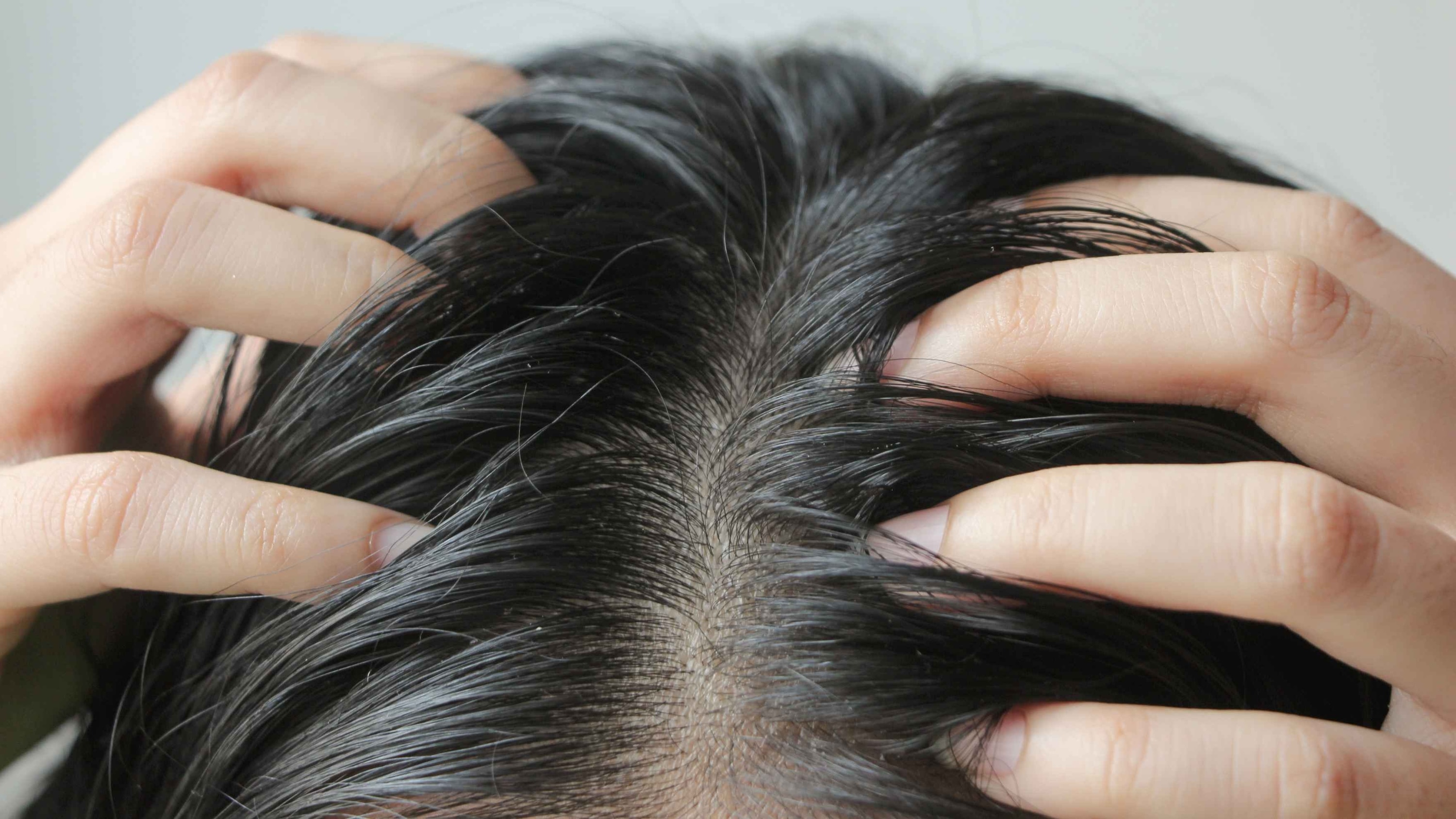 who-should-avoid-oil-treatments