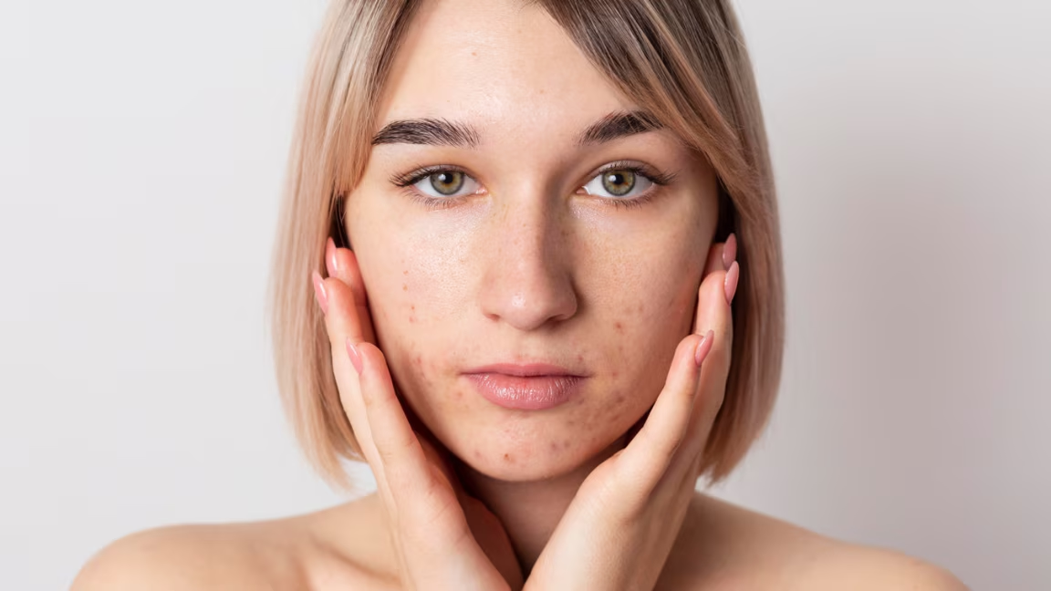 How to Remove Black Spots on Face: Causes, Remedies & Quick Fixes