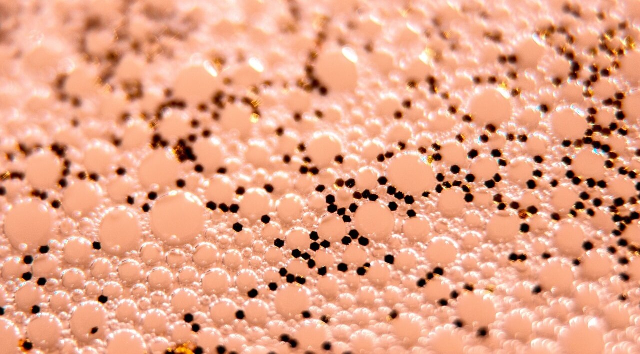 High Concentration of Sebaceous Glands
