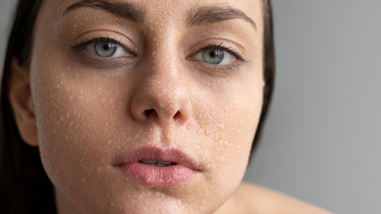 Purging Or Breakouts