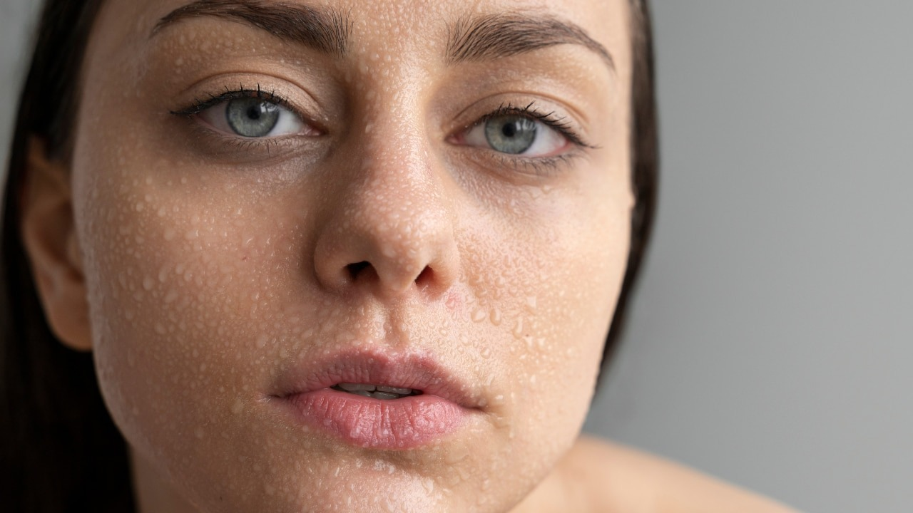 Purging Or Breakouts