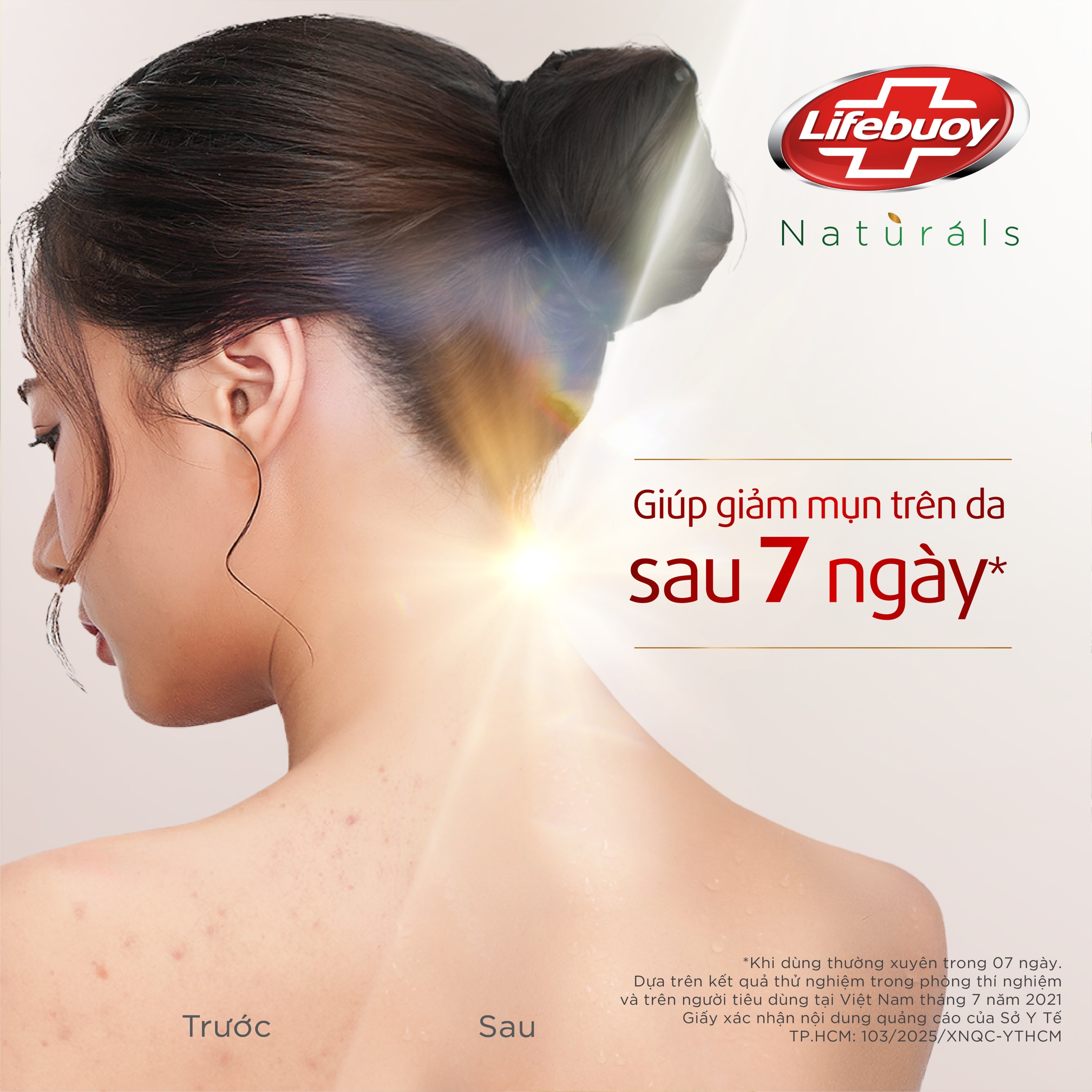 Sữa tắm Lifebuoy Giảm Mụn Matcha & Khổ Qua (Chai)