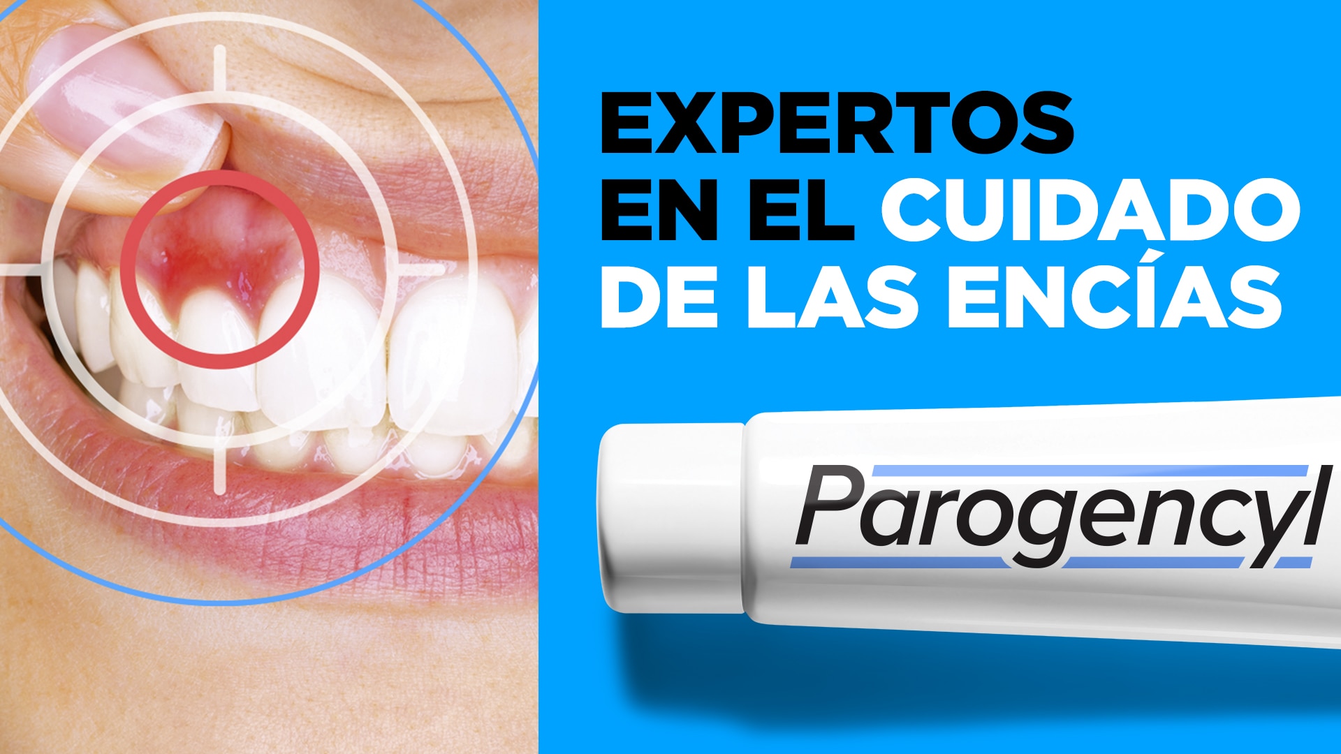 Bienvenido/a a Parogencyl, expertos en el cuidado de encías