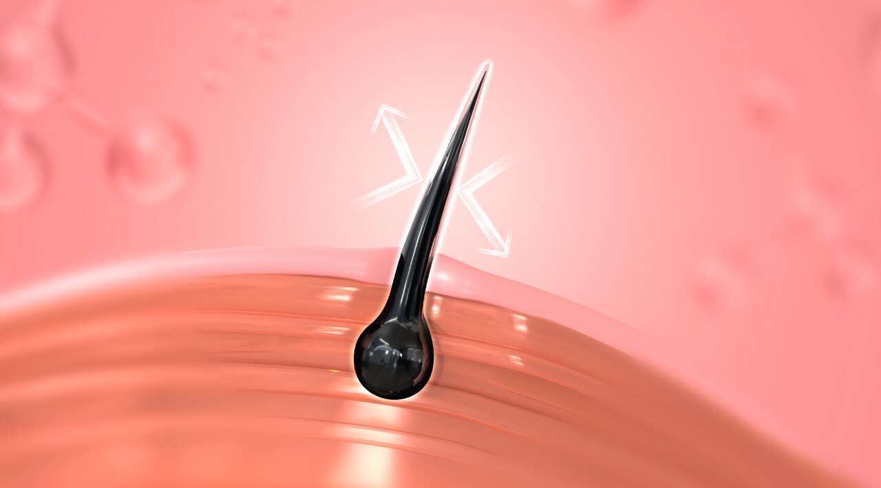 Ingrown hairs image