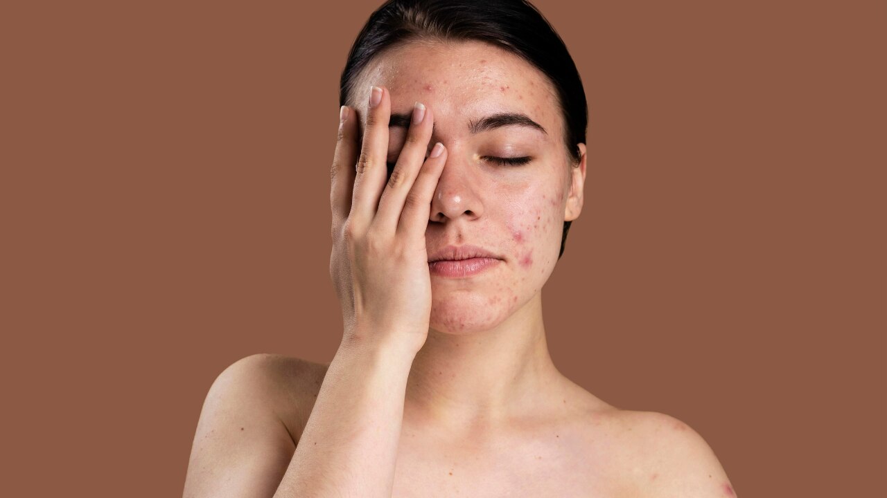Coffee Scrub Benefits for Skin - Fades dark spots