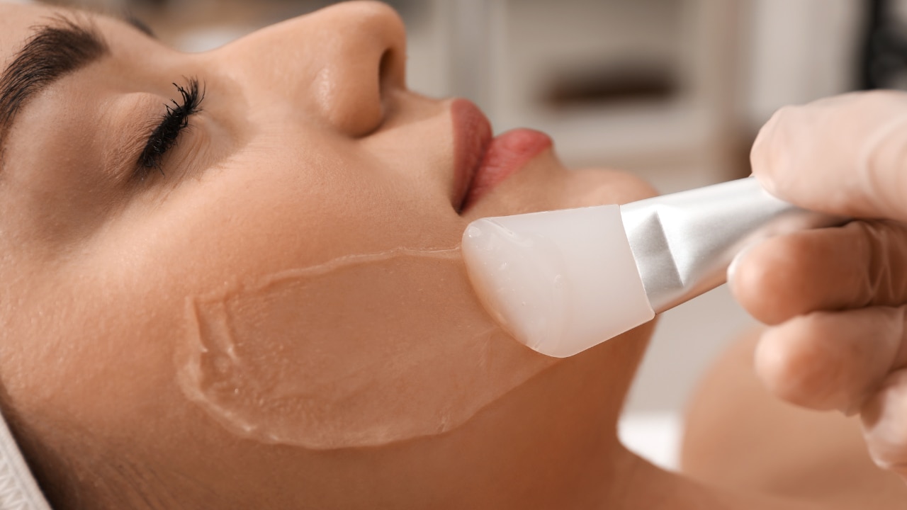Chemical Peels